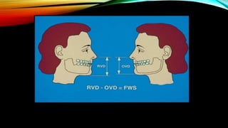 CD clinical tricks (ADEC one day CD)