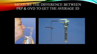 CD clinical tricks (ADEC one day CD)