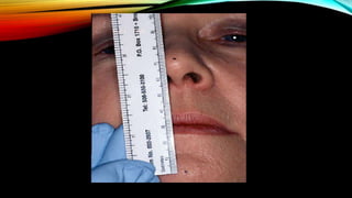 CD clinical tricks (ADEC one day CD)