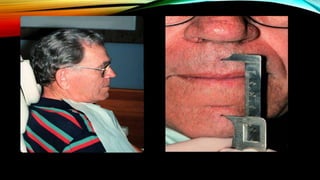 CD clinical tricks (ADEC one day CD)