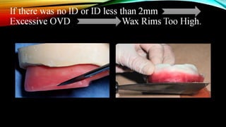 CD clinical tricks (ADEC one day CD)