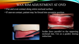 CD clinical tricks (ADEC one day CD)