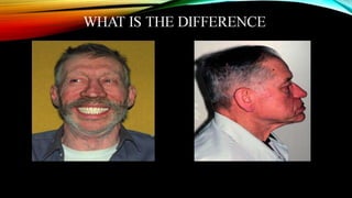 CD clinical tricks (ADEC one day CD)