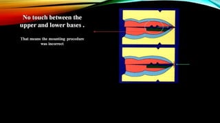 CD clinical tricks (ADEC one day CD)