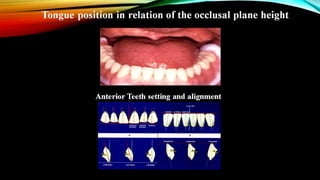 CD clinical tricks (ADEC one day CD)