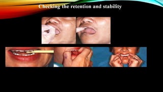 CD clinical tricks (ADEC one day CD)