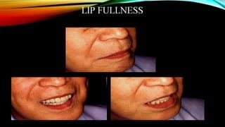 CD clinical tricks (ADEC one day CD)