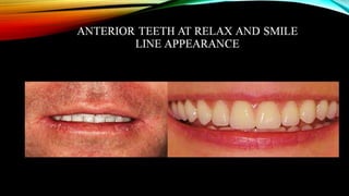 CD clinical tricks (ADEC one day CD)