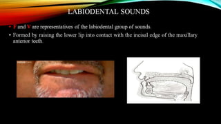 CD clinical tricks (ADEC one day CD)