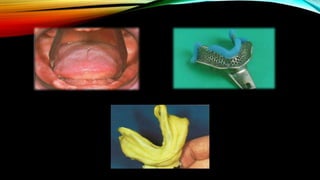 CD clinical tricks (ADEC one day CD)