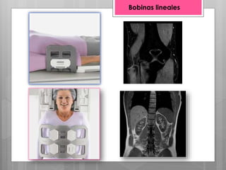 Bobinas lineales
 