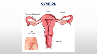 OVÁRIOS
 