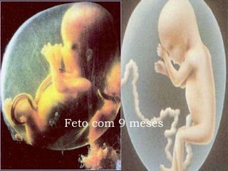 Feto   com   9   meses 