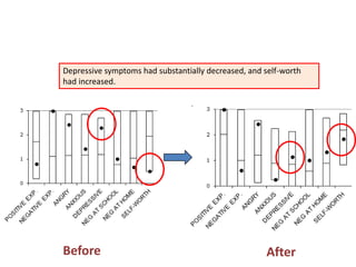 Depressive symptoms had substantially decreased, and self-worth
had increased.
Before After
 