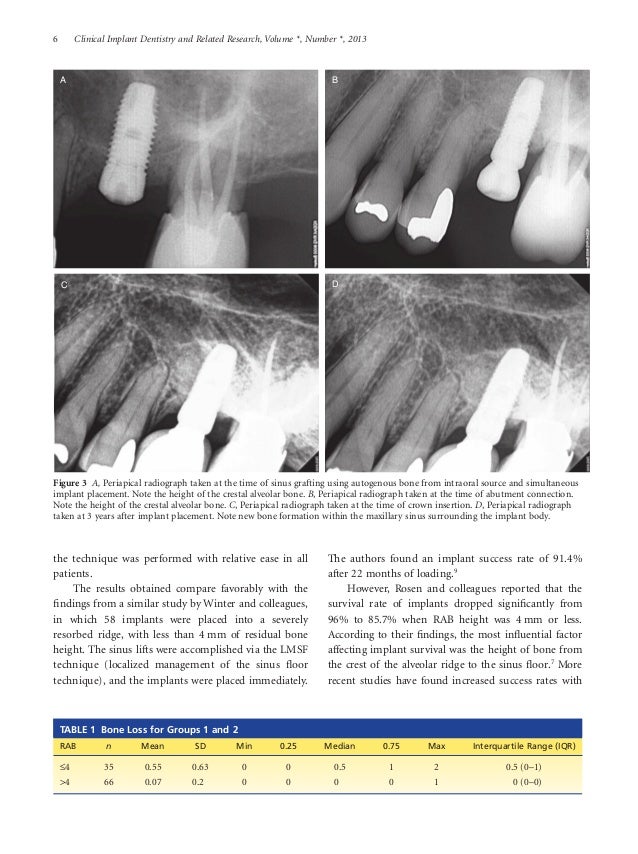 Crestal approach for maxillary sinus augmentation in patients with le…