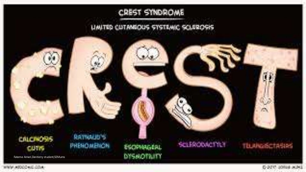 Crest syndrome