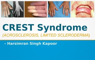 CREST Syndrome
(ACROSCLEROSIS, LIMITED SCLERODERMA)
- Harsimran Singh Kapoor
 
