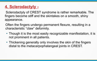 4. Sclerodactyly -
Sclerodactyly of CREST syndrome is rather remarkable. The
fingers become stiff and the skintakes on a smooth, shiny
appearance.
Often the fingers undergo permanent flexure, resulting in a
characteristic “claw” deformity.
●
Though it is the most easily recognizable manifestation, it is
not prominent in all patients.
●
Thickening generally only involves the skin of the fingers
distal to the metacarpophalangeal joints in CREST.
 