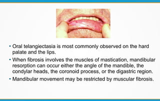 ●
Oral telangiectasia is most commonly observed on the hard
palate and the lips.
●
When fibrosis involves the muscles of mastication, mandibular
resorption can occur either the angle of the mandible, the
condylar heads, the coronoid process, or the digastric region.
●
Mandibular movement may be restricted by muscular fibrosis.
 