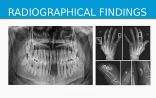 RADIOGRAPHICAL FINDINGS
 