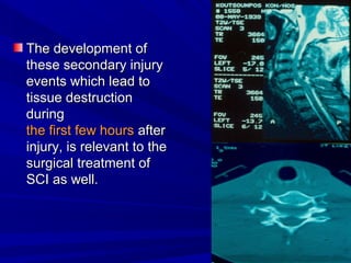 TThhee ddeevveellooppmmeenntt ooff 
tthheessee sseeccoonnddaarryy iinnjjuurryy 
eevveennttss wwhhiicchh lleeaadd ttoo 
ttiissssuuee ddeessttrruuccttiioonn 
dduurriinngg 
tthhee ffiirrsstt ffeeww hhoouurrss aafftteerr 
iinnjjuurryy,, iiss rreelleevvaanntt ttoo tthhee 
ssuurrggiiccaall ttrreeaattmmeenntt ooff 
SSCCII aass wweellll.. 
 