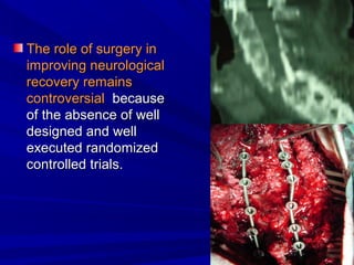 TThhee rroollee ooff ssuurrggeerryy iinn 
iimmpprroovviinngg nneeuurroollooggiiccaall 
rreeccoovveerryy rreemmaaiinnss 
ccoonnttrroovveerrssiiaall bbeeccaauussee 
ooff tthhee aabbsseennccee ooff wweellll 
ddeessiiggnneedd aanndd wweellll 
eexxeeccuutteedd rraannddoommiizzeedd 
ccoonnttrroolllleedd ttrriiaallss.. 
 