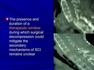 TThhee pprreesseennccee aanndd 
dduurraattiioonn ooff aa 
tthheerraappeeuuttiicc wwiinnddooww 
dduurriinngg wwhhiicchh ssuurrggiiccaall 
ddeeccoommpprreessssiioonn ccoouulldd 
mmiittiiggaattee tthhee 
sseeccoonnddaarryy 
mmeecchhaanniissmmss ooff SSCCII 
rreemmaaiinnss uunncclleeaarr 
 