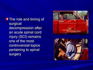 TThhee rroollee aanndd ttiimmiinngg ooff 
ssuurrggiiccaall 
ddeeccoommpprreessssiioonn aafftteerr 
aann aaccuuttee ssppiinnaall ccoorrdd 
iinnjjuurryy ((SSCCII)) rreemmaaiinnss 
oonnee ooff tthhee mmoosstt 
ccoonnttrroovveerrssiiaall ttooppiiccss 
ppeerrttaaiinniinngg ttoo ssppiinnaall 
ssuurrggeerryy 
 