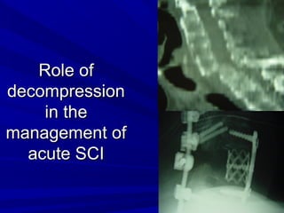 RRoollee ooff 
ddeeccoommpprreessssiioonn 
iinn tthhee 
mmaannaaggeemmeenntt ooff 
aaccuuttee SSCCII 
 