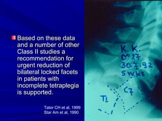 BBaasseedd oonn tthheessee ddaattaa 
aanndd aa nnuummbbeerr ooff ootthheerr 
CCllaassss IIII ssttuuddiieess aa 
rreeccoommmmeennddaattiioonn ffoorr 
uurrggeenntt rreedduuccttiioonn ooff 
bbiillaatteerraall lloocckkeedd ffaacceettss 
iinn ppaattiieennttss wwiitthh 
iinnccoommpplleettee tteettrraapplleeggiiaa 
iiss ssuuppppoorrtteedd.. 
Tator CH et al, 1999 
Star Am et al, 1990 
 