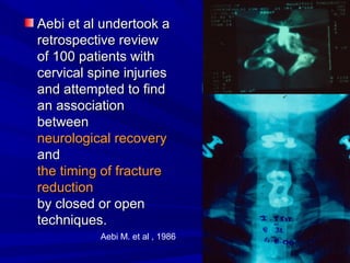 AAeebbii eett aall uunnddeerrttooookk aa 
rreettrroossppeeccttiivvee rreevviieeww 
ooff 110000 ppaattiieennttss wwiitthh 
cceerrvviiccaall ssppiinnee iinnjjuurriieess 
aanndd aatttteemmpptteedd ttoo ffiinndd 
aann aassssoocciiaattiioonn 
bbeettwweeeenn 
nneeuurroollooggiiccaall rreeccoovveerryy 
aanndd 
tthhee ttiimmiinngg ooff ffrraaccttuurree 
rreedduuccttiioonn 
bbyy cclloosseedd oorr ooppeenn 
tteecchhnniiqquueess.. 
Aebi M. et al , 1986 
 