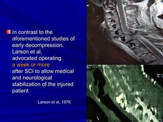 IInn ccoonnttrraasstt ttoo tthhee 
aaffoorreemmeennttiioonneedd ssttuuddiieess ooff 
eeaarrllyy ddeeccoommpprreessssiioonn.. 
LLaarrssoonn eett aall,, 
aaddvvooccaatteedd ooppeerraattiinngg 
aa wweeeekk oorr mmoorree 
aafftteerr SSCCII ttoo aallllooww mmeeddiiccaall 
aanndd nneeuurroollooggiiccaall 
ssttaabbiilliizzaattiioonn ooff tthhee iinnjjuurreedd 
ppaattiieenntt 
Larson et al, 1976 
 