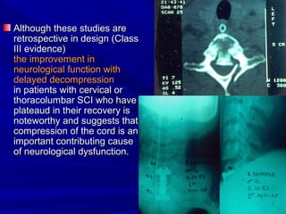 Although tthheessee ssttuuddiieess aarree 
rreettrroossppeeccttiivvee iinn ddeessiiggnn ((CCllaassss 
IIIIII eevviiddeennccee)) 
tthhee iimmpprroovveemmeenntt iinn 
nneeuurroollooggiiccaall ffuunnccttiioonn wwiitthh 
ddeellaayyeedd ddeeccoommpprreessssiioonn 
iinn ppaattiieennttss wwiitthh cceerrvviiccaall oorr 
tthhoorraaccoolluummbbaarr SSCCII wwhhoo hhaavvee 
ppllaatteeaauudd iinn tthheeiirr rreeccoovveerryy iiss 
nnootteewwoorrtthhyy aanndd ssuuggggeessttss tthhaatt 
ccoommpprreessssiioonn ooff tthhee ccoorrdd iiss aann 
iimmppoorrttaanntt ccoonnttrriibbuuttiinngg ccaauussee 
ooff nneeuurroollooggiiccaall ddyyssffuunnccttiioonn.. 
 
