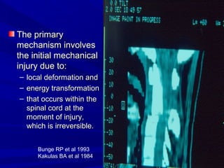 TThhee pprriimmaarryy 
mmeecchhaanniissmm iinnvvoollvveess 
tthhee iinniittiiaall mmeecchhaanniiccaall 
iinnjjuurryy dduuee ttoo:: 
– llooccaall ddeeffoorrmmaattiioonn aanndd 
– eenneerrggyy ttrraannssffoorrmmaattiioonn 
– tthhaatt ooccccuurrss wwiitthhiinn tthhee 
ssppiinnaall ccoorrdd aatt tthhee 
mmoommeenntt ooff iinnjjuurryy,, 
wwhhiicchh iiss iirrrreevveerrssiibbllee.. 
Bunge RP et al 1993 
Kakulas BA et al 1984 
 