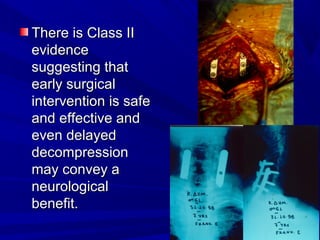 TThheerree iiss CCllaassss IIII 
eevviiddeennccee 
ssuuggggeessttiinngg tthhaatt 
eeaarrllyy ssuurrggiiccaall 
iinntteerrvveennttiioonn iiss ssaaffee 
aanndd eeffffeeccttiivvee aanndd 
eevveenn ddeellaayyeedd 
ddeeccoommpprreessssiioonn 
mmaayy ccoonnvveeyy aa 
nneeuurroollooggiiccaall 
bbeenneeffiitt.. 
 