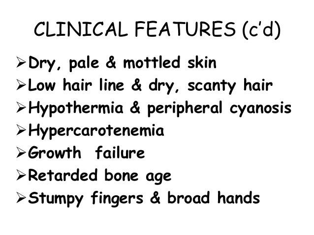 Cretinism & hypoth...
