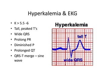Hyperkalemia & EKG
•   K > 5.5 -6
•   Tall, peaked T’s
•   Wide QRS
•   Prolong PR
•   Diminished P
•   Prolonged QT
•   QRS-T merge – sine
    wave
 