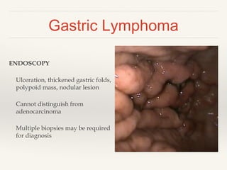 ENDOSCOPY
Ulceration, thickened gastric folds,
polypoid mass, nodular lesion
Cannot distinguish from
adenocarcinoma
Multiple biopsies may be required
for diagnosis
Gastric Lymphoma
 
