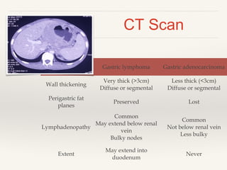 Gastric lymphoma Gastric adenocarcinoma
Wall thickening
Very thick (>3cm)
Diffuse or segmental
Less thick (<3cm)
Diffuse or segmental
Perigastric fat
planes
Preserved Lost
Lymphadenopathy
Common
May extend below renal
vein
Bulky nodes
Common
Not below renal vein
Less bulky
Extent
May extend into
duodenum
Never
CT Scan
 