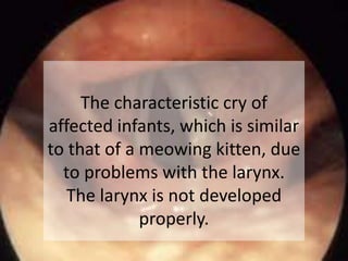 The characteristic cry of
affected infants, which is similar
to that of a meowing kitten, due
to problems with the larynx.
The larynx is not developed
properly.
 