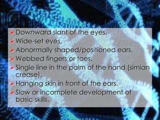 Downward slant of the eyes.
Wide-set eyes.
Abnormally shaped/positioned ears.
Webbed fingers or toes.
Single line in the palm of the hand (simian
crease).
Hanging skin in front of the ears.
Slow or incomplete development of
basic skills.
 