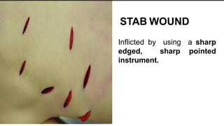types of wound and instrument used to cause wound.pptx
