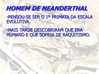HOMEM DE NEANDERTHAL
-PENSOU-SE SER O 1º PRIMATA DA ESCALA
EVOLUTIVA.
-MAIS TARDE DESCOBRIRAM QUE ERA
HUMANO E QUE SOFRIA DE RAQUITISMO.
 
