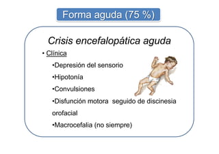 Crisis encefalopática aguda
• Clínica
•Depresión del sensorio
•Hipotonía
•Convulsiones
•Disfunción motora seguido de discinesia
orofacial
•Macrocefalia (no siempre)
Forma aguda (75 %)
 