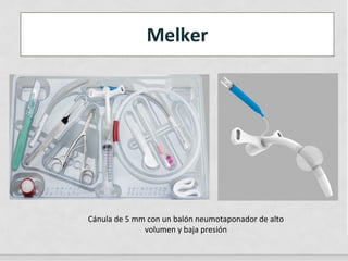 Melker
Cánula de 5 mm con un balón neumotaponador de alto
volumen y baja presión
 