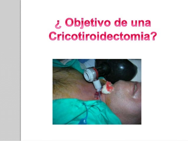Cricotiroidotomía