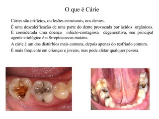 O que é Cárie
Cáries são orifícios, ou lesões estruturais, nos dentes.
É uma descalcificação de uma parte do dente provocada por ácidos orgânicos.
É considerada uma doença infecto-contagiosa degenerativa, seu principal
agente etiológico é o Streptococcus mutans.
A cárie é um dos distúrbios mais comuns, depois apenas do resfriado comum.
É mais frequente em crianças e jovens, mas pode afetar qualquer pessoa.

 