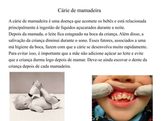 Cárie de mamadeira
A cárie de mamadeira é uma doença que acomete os bebês e está relacionada
principalmente à ingestão de líquidos açucarados durante a noite.
Depois da mamada, o leite fica estagnado na boca da criança. Além disso, a
salivação da criança diminui durante o sono. Esses fatores, associados a uma
má higiene da boca, fazem com que a cárie se desenvolva muito rapidamente.
Para evitar isso, é importante que a mãe não adicione açúcar ao leite e evite
que a criança durma logo depois de mamar. Deve-se ainda escovar o dente da
criança depois de cada mamadeira.

 