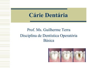 Cárie Dentária

    Prof. Ms. Guilherme Terra
Disciplina de Dentística Operatória
              Básica
 
