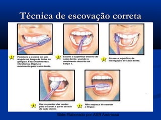 Técnica de escovação correta




        Slide Elaborado por ASB Andressa
 